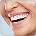 Oral-b Pro 700 Sensi Ultrathin Adulto Spazzolino Rotante-oscillante Blu, Bianco - Foto miniatura 2