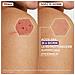 Epitheliale Ultra Repair Crema Ristrutturante Anti Segni Residui 40 ml - Foto miniatura 4