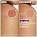 Epitheliale Ultra Repair Crema Ristrutturante Anti Segni Residui 100 ml - Foto miniatura 4