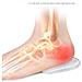 Coppe Del Tallone In Gel Di Silicone, Inserti Per Scarpe, Ammortizzanti, Supporto 1 Paio S - Foto miniatura 4