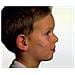 Cerotto per Sutura Nexcare Steristrip 6X75 mm + 3X75 mm - Foto miniatura 1
