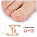 Toppe Per La Correzione Delle Dita Dei Piedi Benda Per La Correzione Delle Unghie Incarnite - Foto miniatura 1