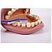 03.083 Denti Giganti Dimostrazione Modello Dentale - Foto miniatura 3