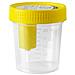 Contenitore Raccolta Urina Linea F 120 Ml - Foto miniatura 1