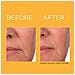 Prevage Progressive Renewal Treatment Creme Antirughe E Antietà, 4 Pz - Foto miniatura 2