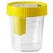 Contenitore Urina Sterile Medipresteril con Sistema Transfert per Provette Sottovuoto - Foto miniatura 1
