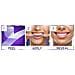 Strisce Sbiancanti Crest Whitestrips Professional Effects Un Trattamento Continuo Di 10 Giorni - Foto miniatura 3
