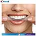 Strisce Sbiancanti Whitestrips Professional Effects Un Trattamento Continuo Di 20 Giorni - Foto miniatura 2