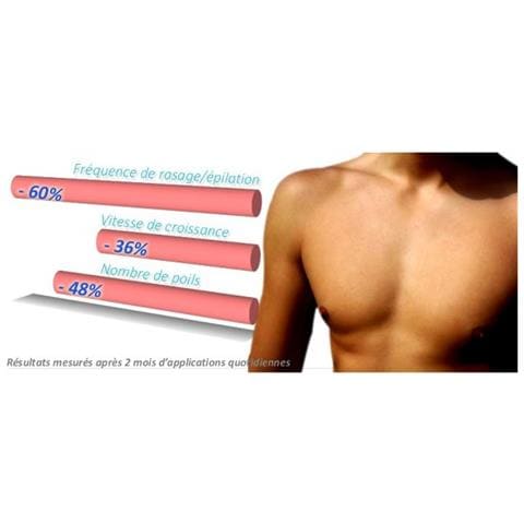 Lozione Epil Xpress Per La Riduzione Dei Peli Del Corpo Maschile - Foto 1