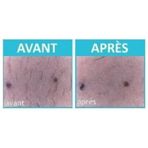 Lozione Per La Cura Del Corpo Epil Xpress Woman - Foto 6