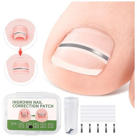 Set Di Cerotti Correttivi Per Unghie Incarnite - 10 Cerotti  16 Mm - Foto 1