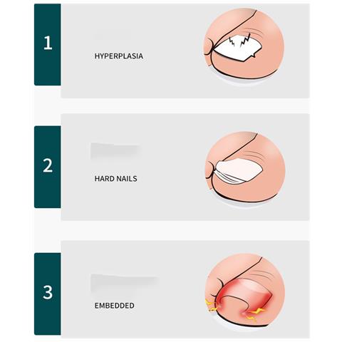 Tronchesino Obliquo Di Precisione Con Ampia Apertura Green - Foto 7