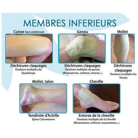 Giunti Muscolari Professionali Per Pomate Fredde Attive Cryo'argile - Foto 7