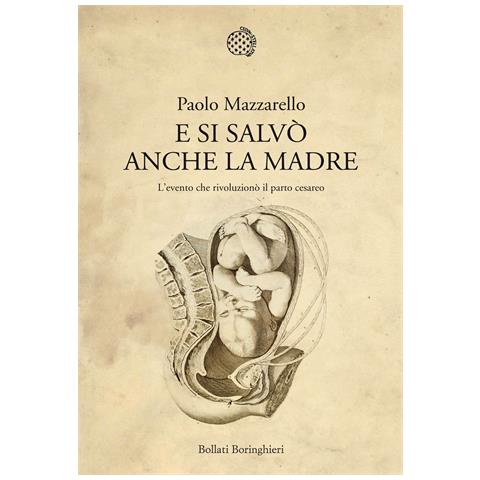 Paolo Mazzarello - E si salvò anche la madre. L'evento che rivoluzionò il parto cesareo - Foto 1