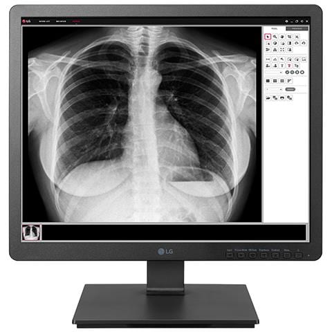 19HK312C Monitor PC 48,3 cm (19") 1280 x 1024 Pixel SXGA LED Nero - Foto 1