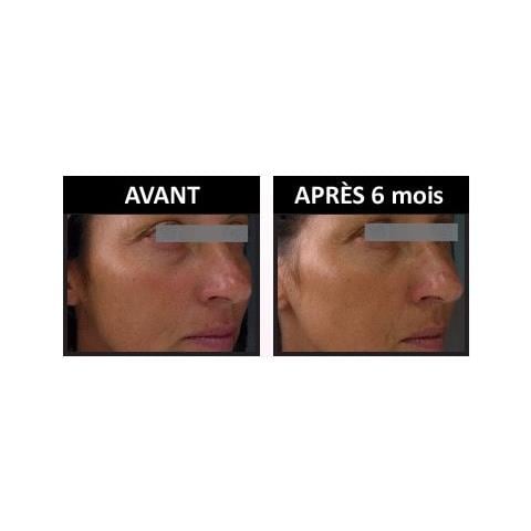 Olio Di Argan Anti-aging Con Olio Di Argan Correzione Di Rughe, Macchie E Arrossamenti - Foto 5