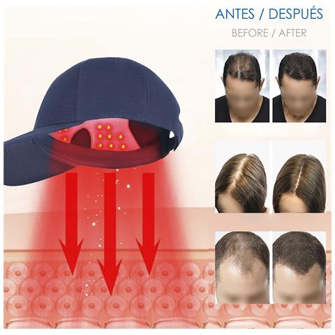 Cappello Massaggiante Con Trattamento Per Capelli Tramite Luce Led. Migliora La Circolazione, Aiuta A Rinforzare E Anti-caduta. - Foto 2