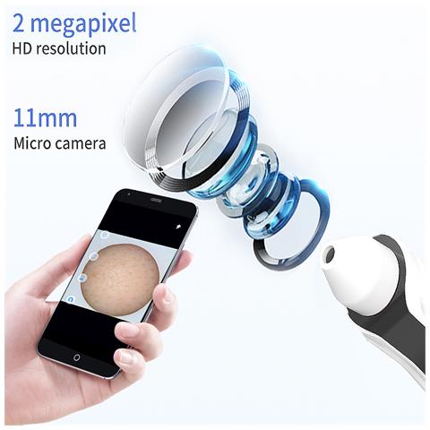 Strumento Per La Pulizia Dei Punti Neri Regolabile 3 Livelli Grande Potenza Di Aspirazione. - Foto 5