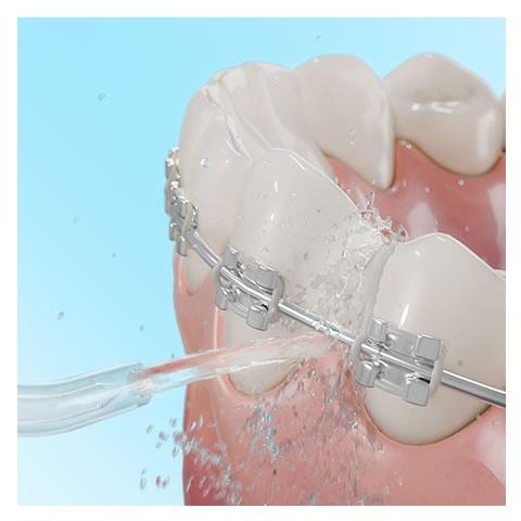 04315 idropulsore 1 L - Foto 8