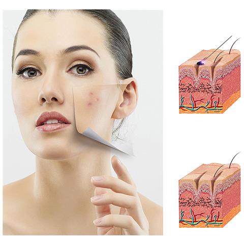 Strumento Di Raschiatura Dei Meridiani Elettrico Senza Fili, Microcorrente Ems. Strumento Di Bellezza Con Luce Rossa, Verde E Blu. - Foto 5