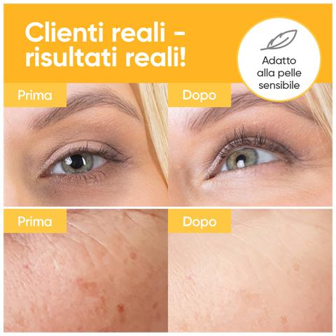 Retinolo & Vitamina C Siero Illuminante | Idratazione Profonda E Pelle Uniforme - Foto 2