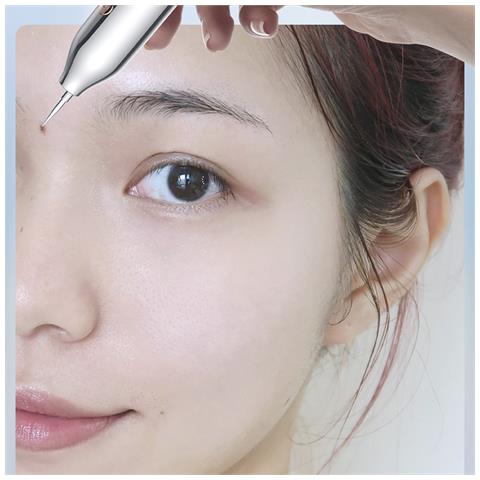 Penna Per Nevo. Per Lentiggini, Placche Senili, Nevi Piatti, Ecc. 2,8x2,8x19 Cm. Color Argento - Foto 2