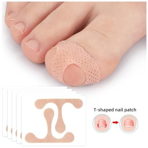 Toppe Per La Correzione Delle Dita Dei Piedi Benda Per La Correzione Delle Unghie Incarnite - Foto 1