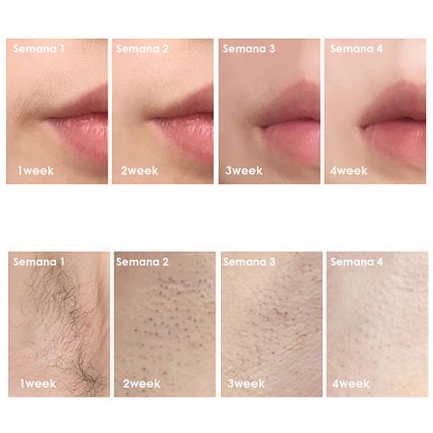 Ts6 Depilatore Ipl A Luce Pulsata Con Schermo Display E Protezione Blackout. - Foto 2