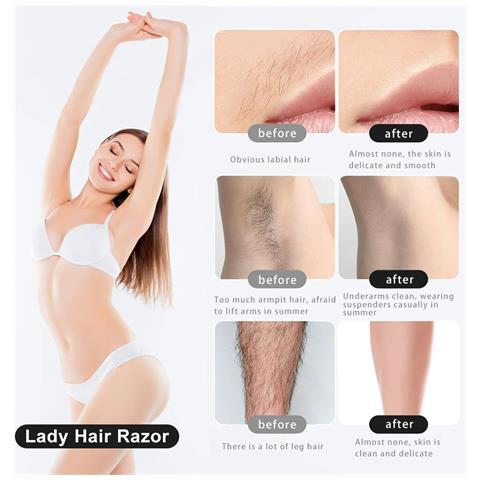 Rasoio Elettrico Multifunzione Per Donna E Uomo: Depilazione Delicata E Precisa Pink - Foto 5