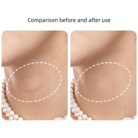 Patch Antirughe Per Il Collo - Riduce Le Linee Sottili (5 Patch) - Foto 2