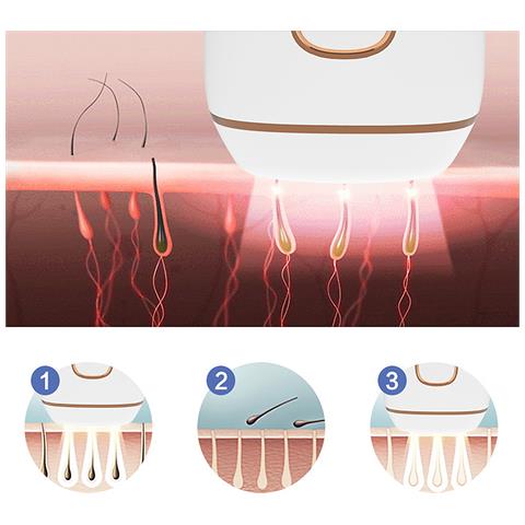 T5s Depilatore Ipl A Luce Pulsata. Testa Sostituibile. Alta Intensità 999,999. - Foto 6