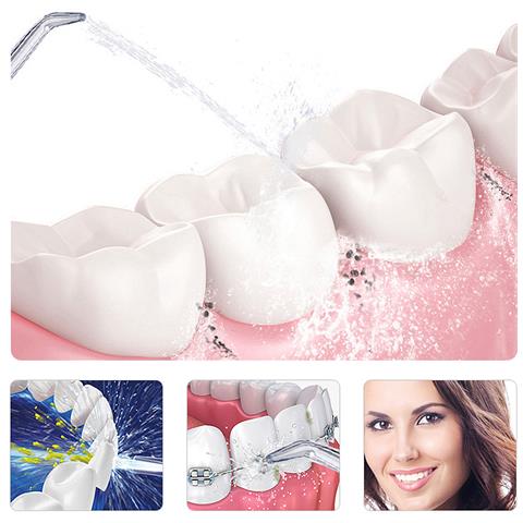 Irrigatore Orale Pulizia E Bellezza Complete Dei Tuoi Denti. Tecnologia A Pulsazione Ad Alta Frequenza. Con 3 Testine. - Foto 5