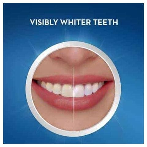 Strisce Sbiancanti Whitestrips Gentle Professional Effects Un Trattamento Continuo Di 14 Giorni - Foto 2