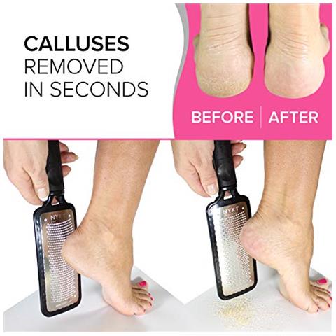 Megafile Lima Per Piedi Per Rimozione Calli Per Piedi (misura Xl) Scrubber Per Piedi Scrubber Per Piedi Rimozione Pelle Morta Per Piedi Raschietto Per Piedi Pelle Dura Rimozione Calli Per Piedi - Pietra Pomice Per Piedi Rimozione Calli - Foto 2