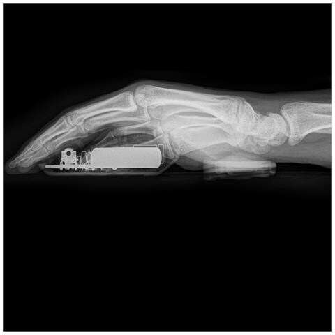 Carpio 2.0 Ergonomic Wrist Rest Black - Foto 5