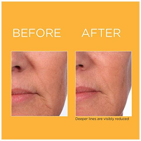 Prevage Progressive Renewal Treatment Creme Antirughe E Antietà, 4 Pz - Foto 2