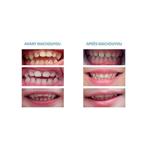 Masticatorio Primi Denti - Foto 2