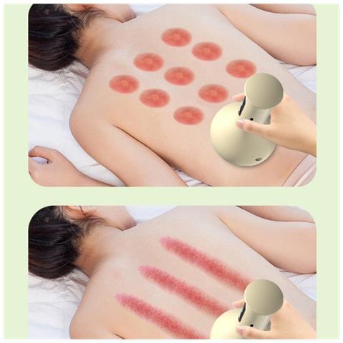 Massaggiatore Elettrico A Ventosa E Raschiamento - Dispositivo Smart Vacuum Gua Sha Con Riscaldamento - Foto 2