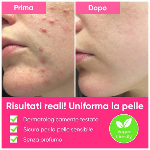 Esfolianti Così Efficaci | Gel Esfoliante Aha Bha Delicato Per Una Pelle Liscia E Luminosa - Foto 2