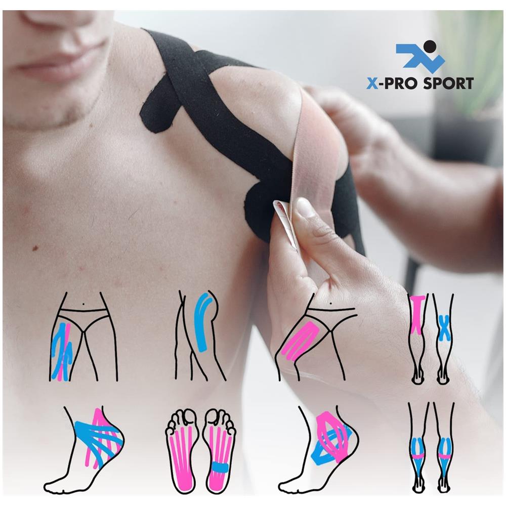 Nastro Kinesiologico 5m X 5cm, Kinesio Tape Con E-book Con Esempi Applicazione, Cerotto Muscolare, Taping Forte Resistente Elastico (2 X Nero) - Foto 2