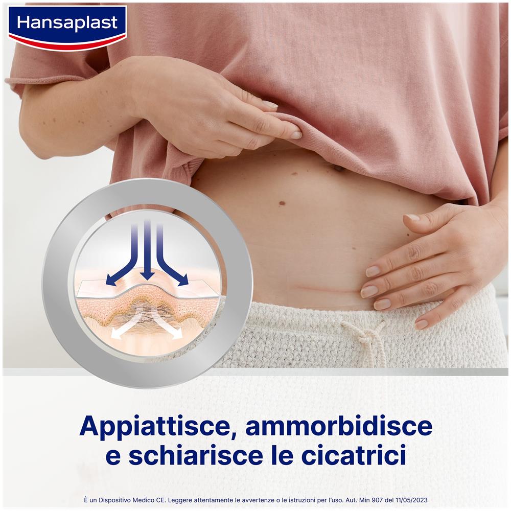 Cerotto Riduzione Cicatrici Hansaplast Med 21 Pezzi - Foto 4