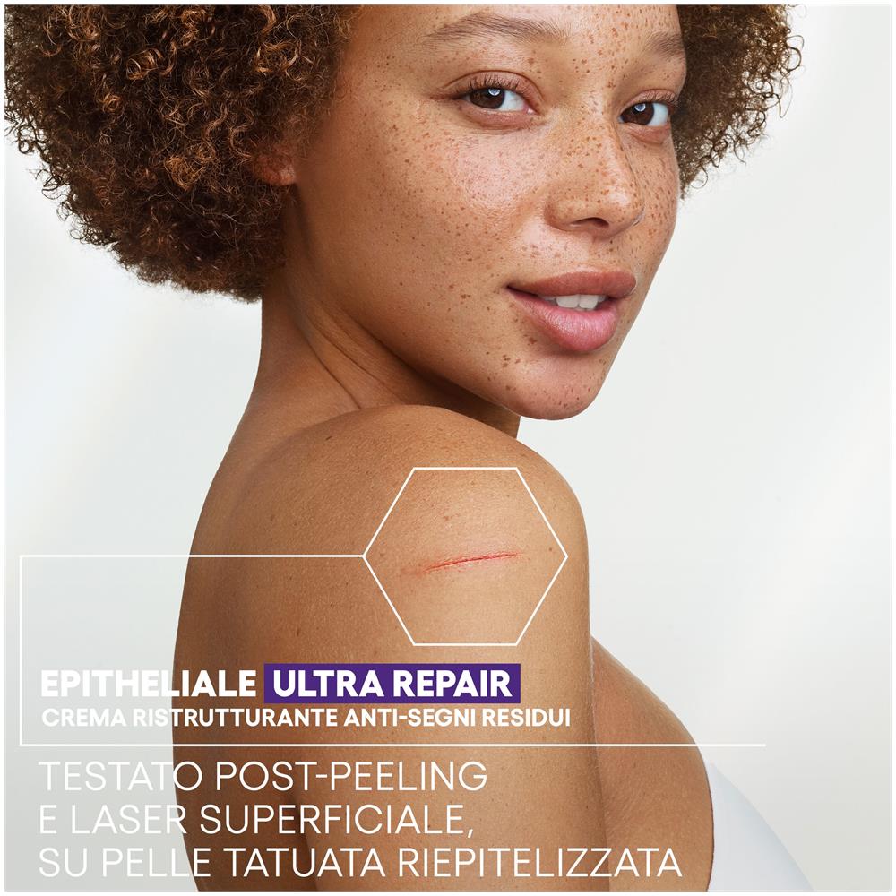 Epitheliale Ultra Repair Crema Ristrutturante Anti Segni Residui 100 ml - Foto 2