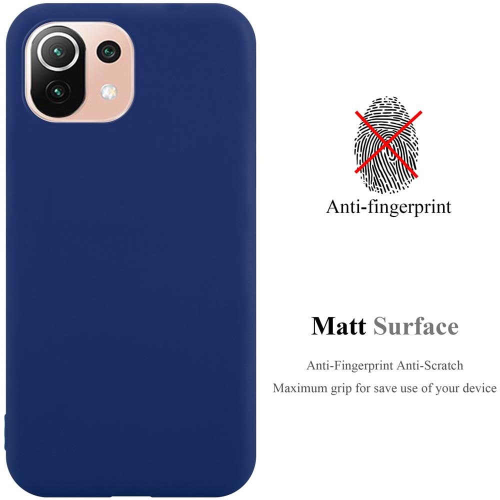 Custodia Compatibile Con Xiaomi Mi 11 Lite (4g / 5g) / 11 Lite Ne In Candy Blu Scuro - Coperchio Protettivo In Silicone Tpu Flessibile - Foto 2