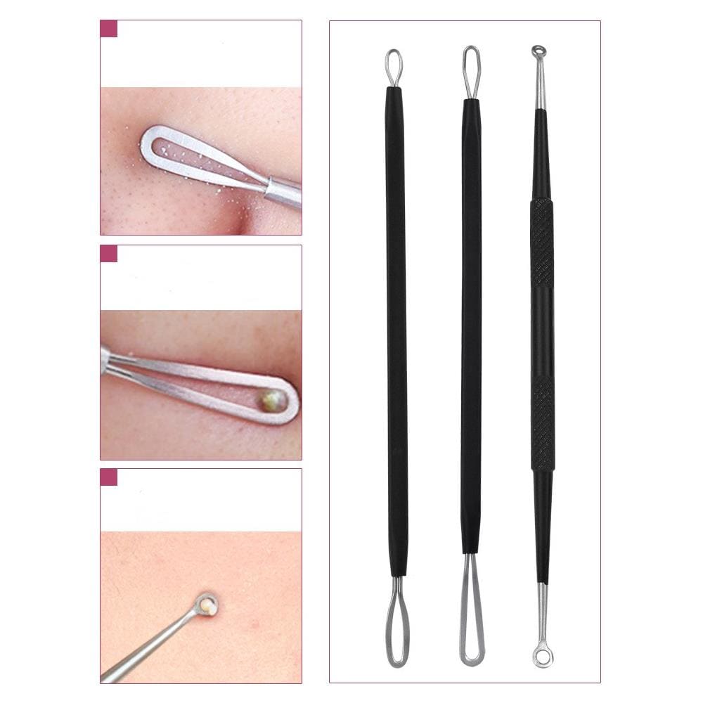 Confezione Da 5 Kit Di Strumenti Per Aghi Per Rimozione Di Punti Neri Black - Foto 2
